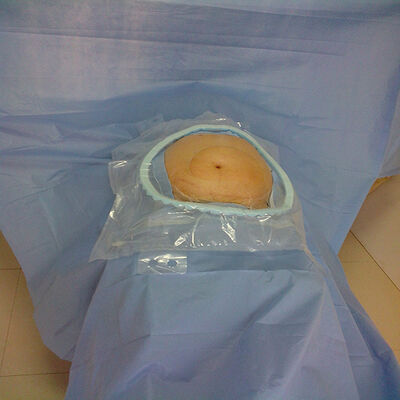 Wysokochłonne jednorazowe zestawy chirurgiczne ze wzmocnionymi chłonnymi strefami krytycznymi i sterylizacją EO dla szpitalnych oddziałów ratunkowych